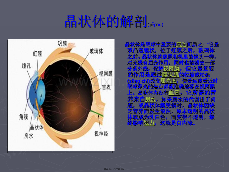 学术讨论—白内障超声乳化--(2).ppt_第3页