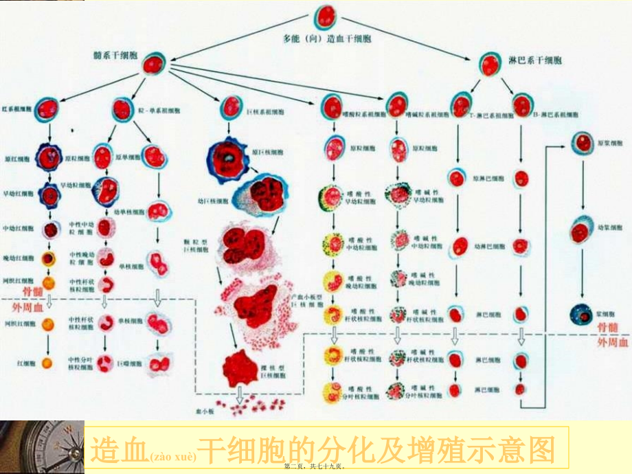 白血病讲课PPT.ppt_第2页