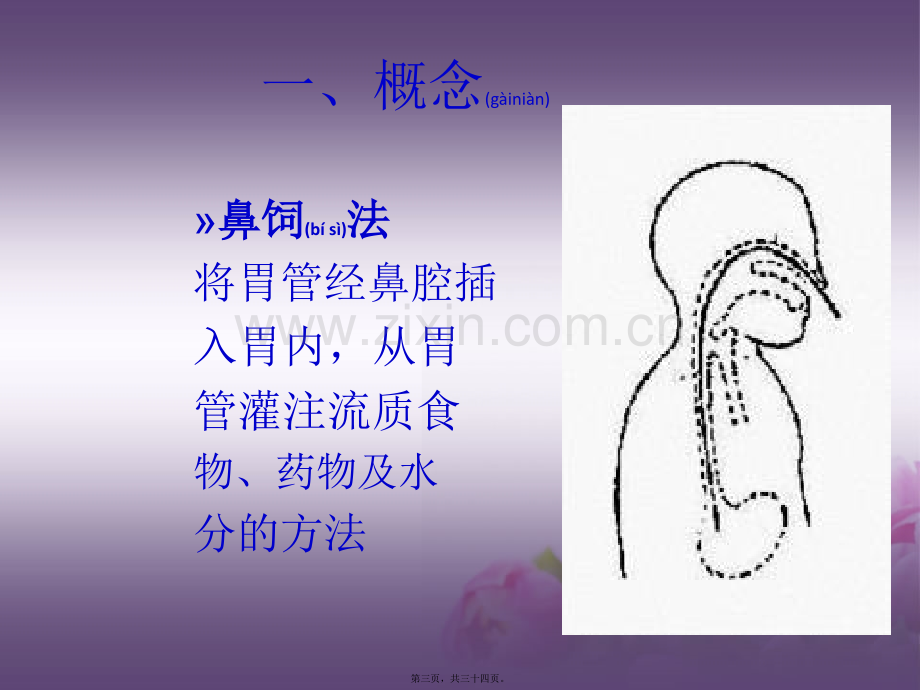 版鼻饲法操作PPT.ppt_第3页