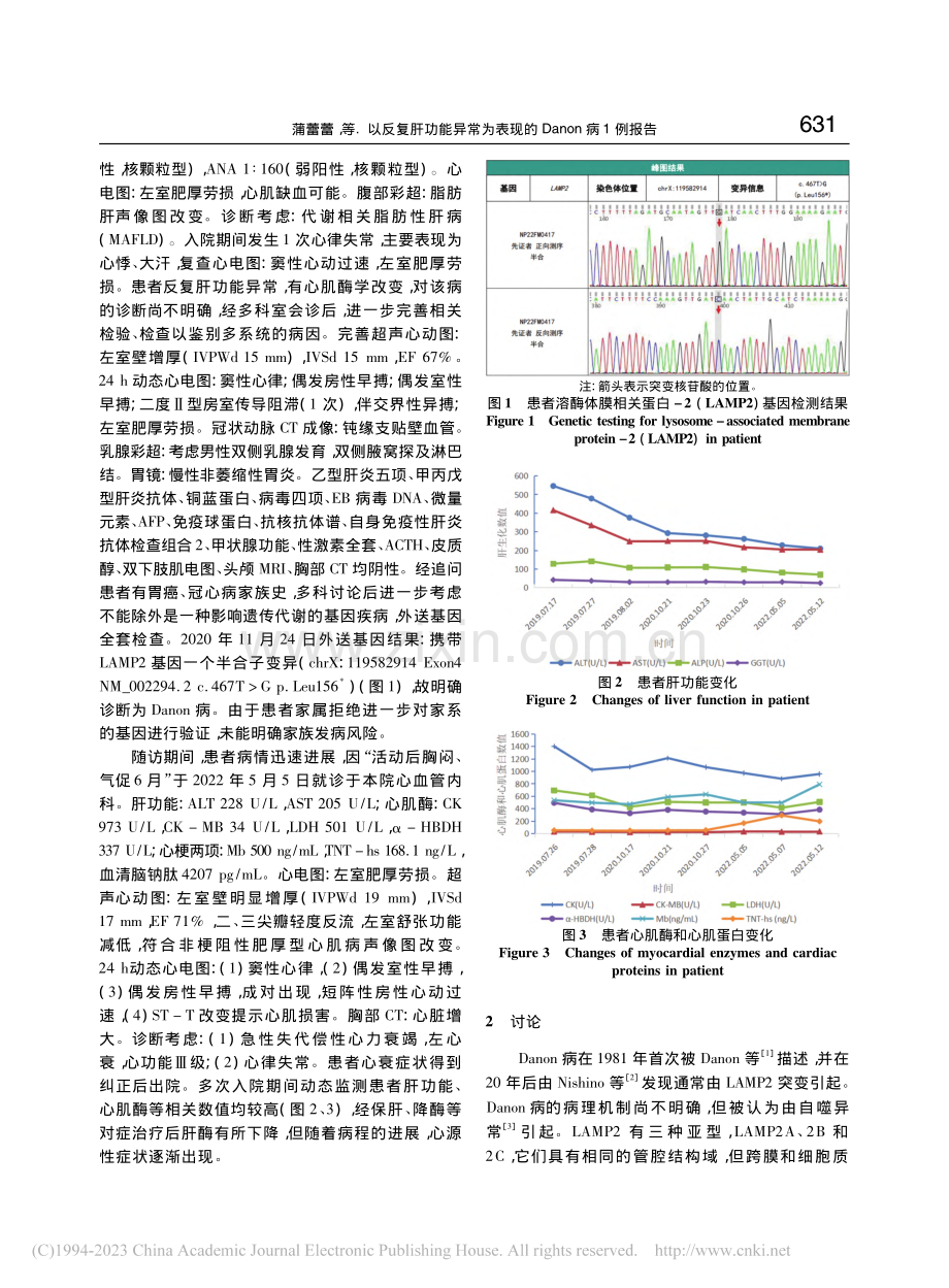 以反复肝功能异常为表现的Danon病1例报告_蒲蕾蕾.pdf_第2页