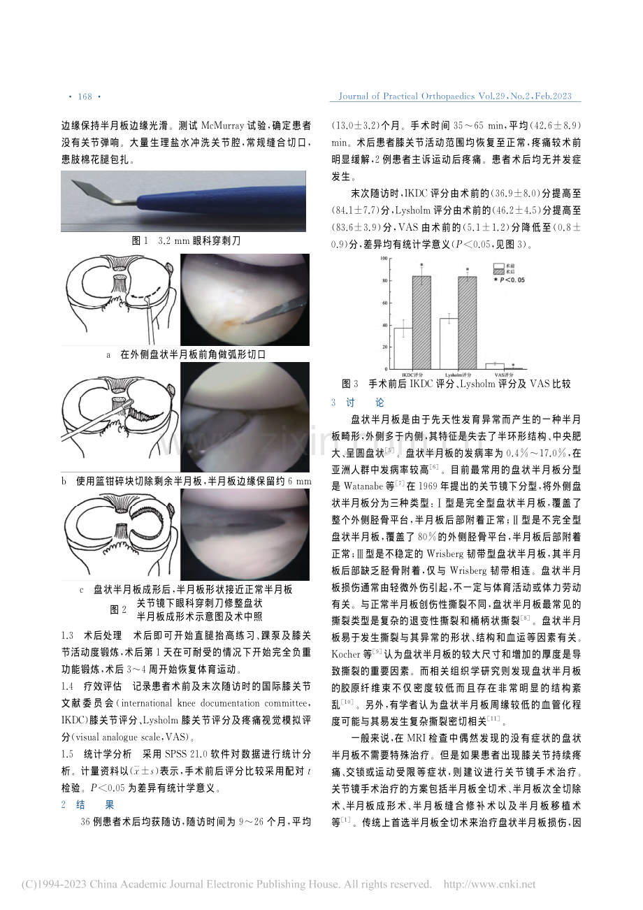 眼科穿刺刀在关节镜下盘状半月板成形术中的临床应用_秦超西.pdf_第2页