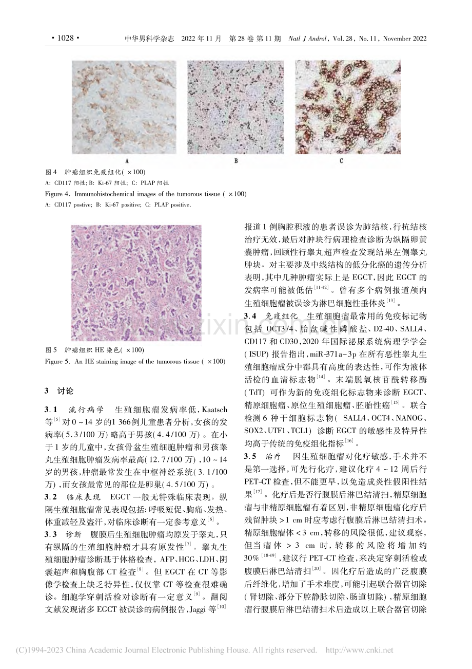 性腺外生殖细胞瘤1例报告并文献复习_李平.pdf_第3页