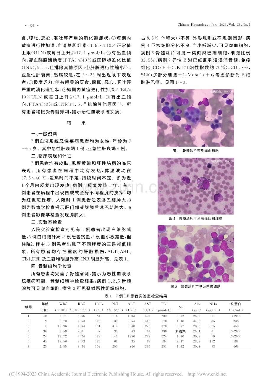 以肝衰竭为首要表现的恶性血液系统疾病——附7例报道_赖曼.pdf_第2页