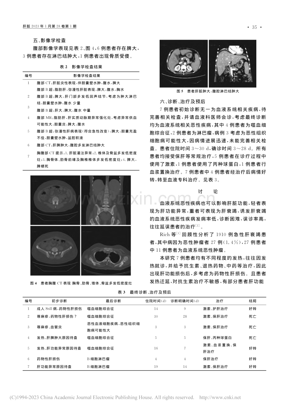 以肝衰竭为首要表现的恶性血液系统疾病——附7例报道_赖曼.pdf_第3页