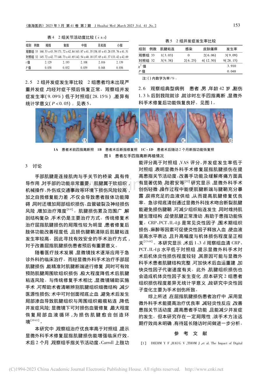 显微外科手术修复屈指肌腱损伤的效果观察_宋振磊.pdf_第3页