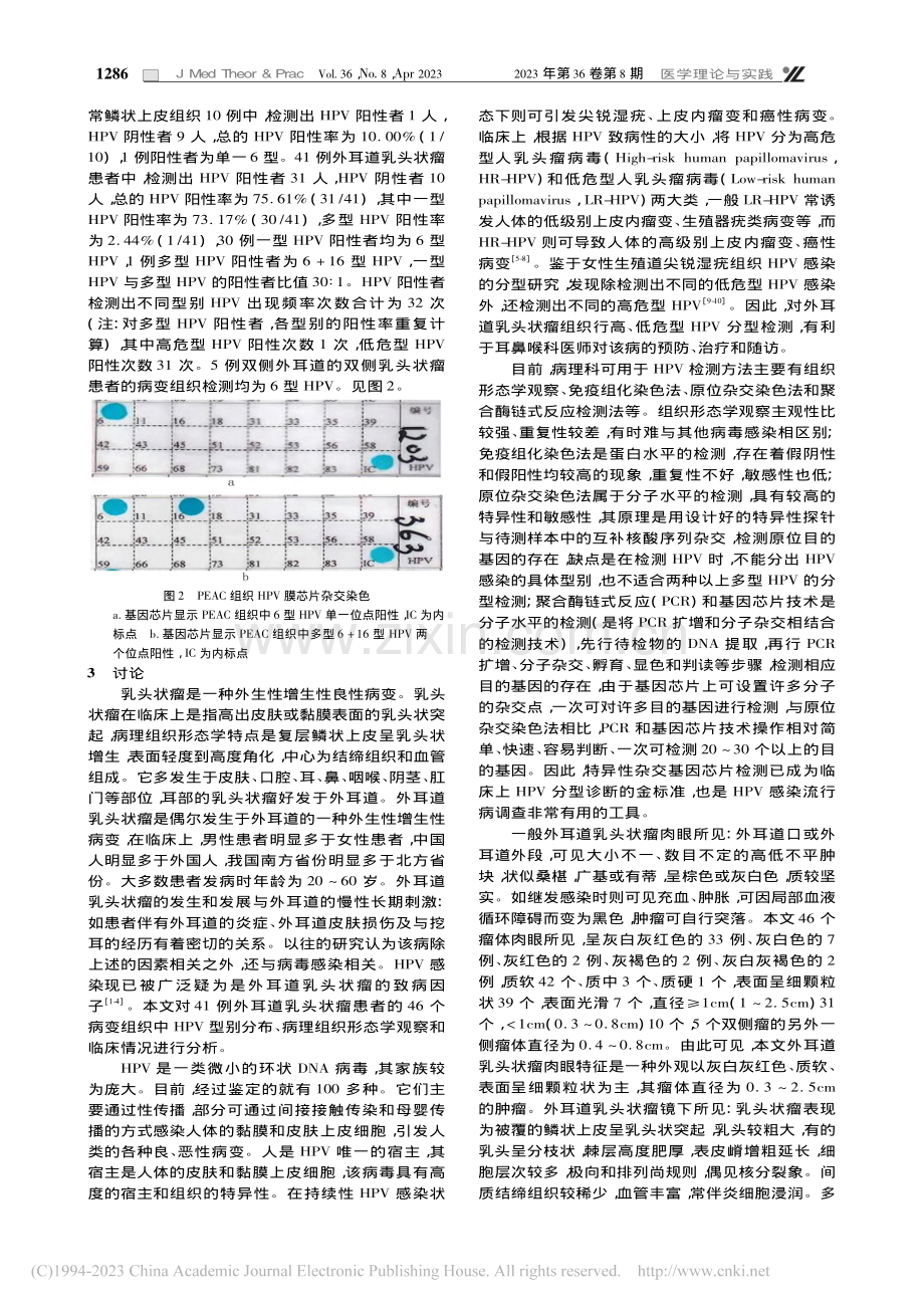 外耳道乳头状瘤组织形态学观察及HPV分型的分析_梅静.pdf_第3页