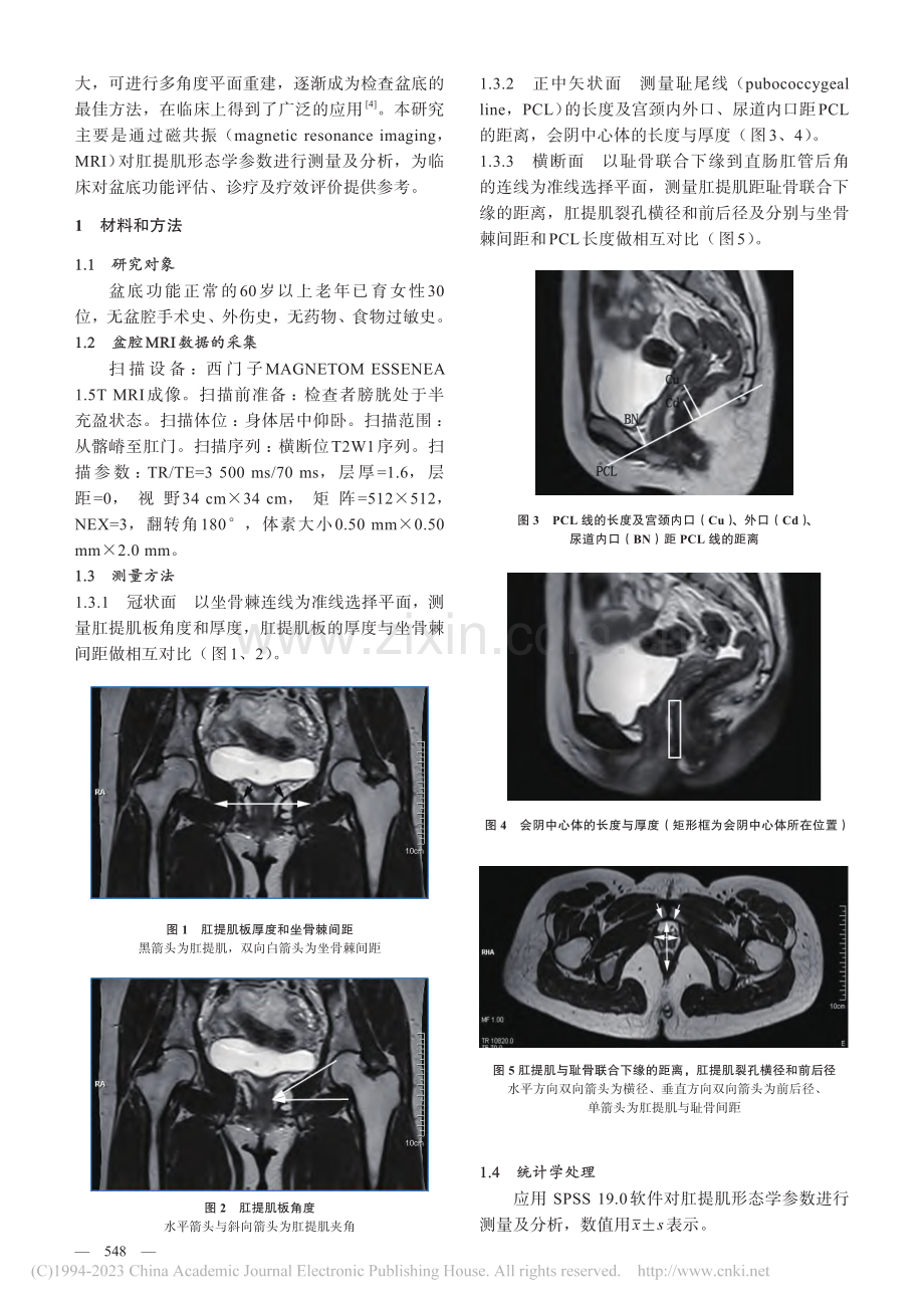 正常老年女性肛提肌磁共振测量_宋宇.pdf_第2页