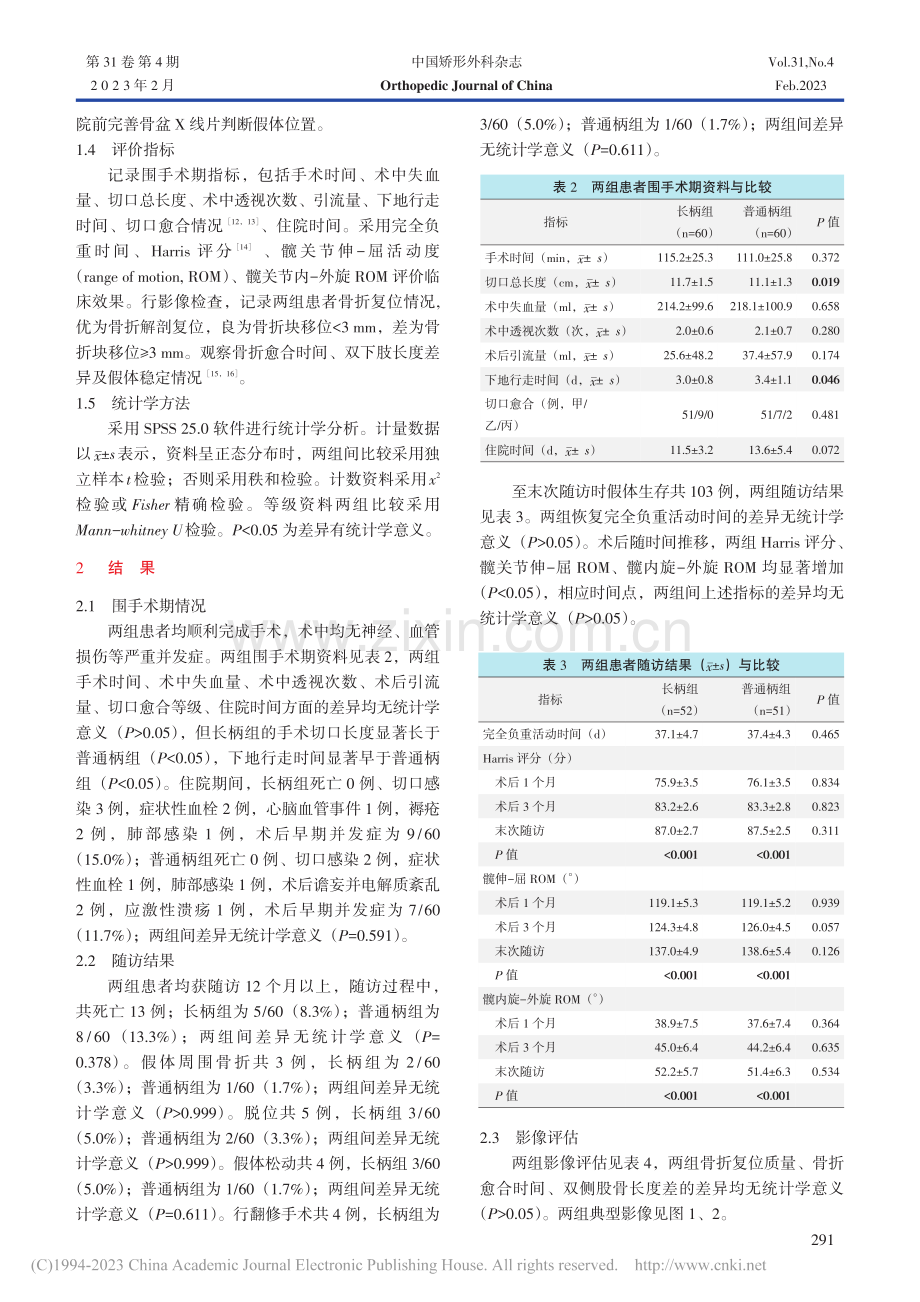 长柄与普通柄半髋置换治疗老年股骨粗隆间骨折_冯茹.pdf_第3页