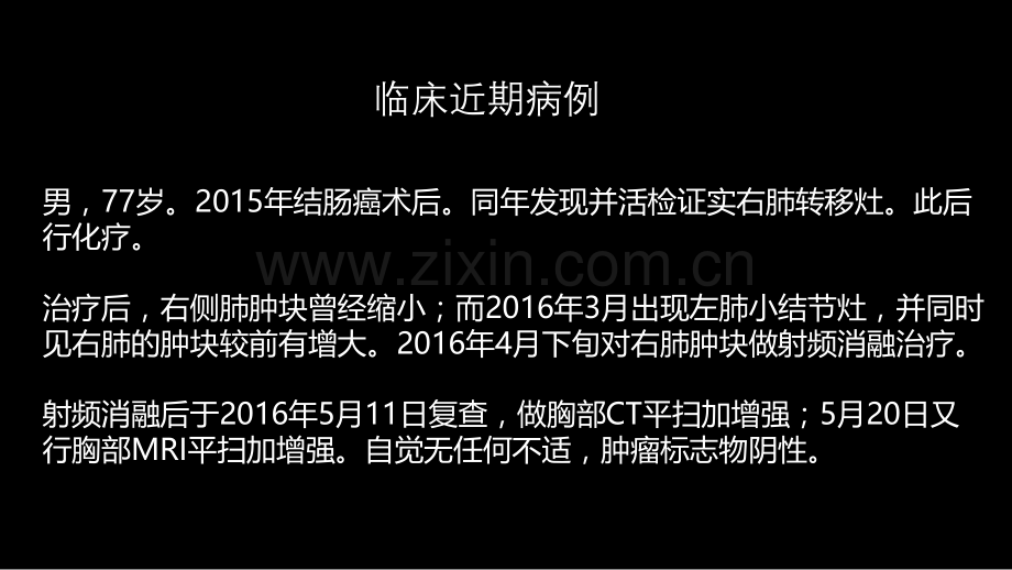 这例肺部病灶的比较影像学：价值评判.pptx_第3页