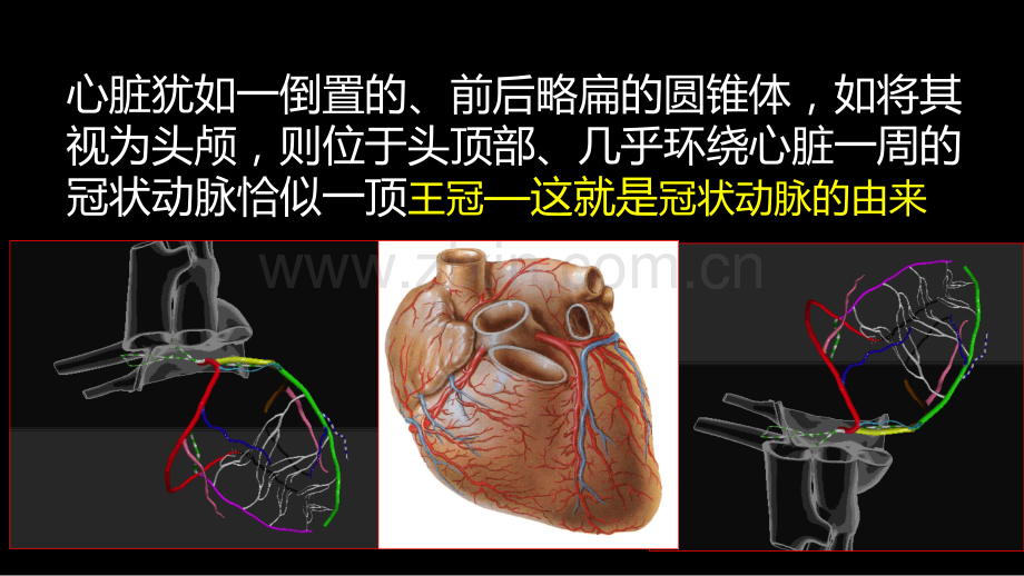 多层螺旋CT冠状动脉疾病诊断再学习之一.ppt_第3页