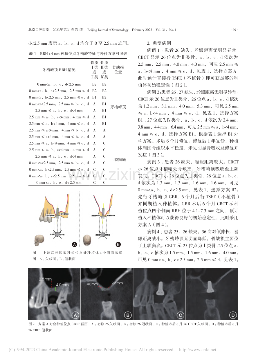 上颌窦底剩余骨高度小于4_...的种植外科方案及适应症探讨_高文莫.pdf_第3页