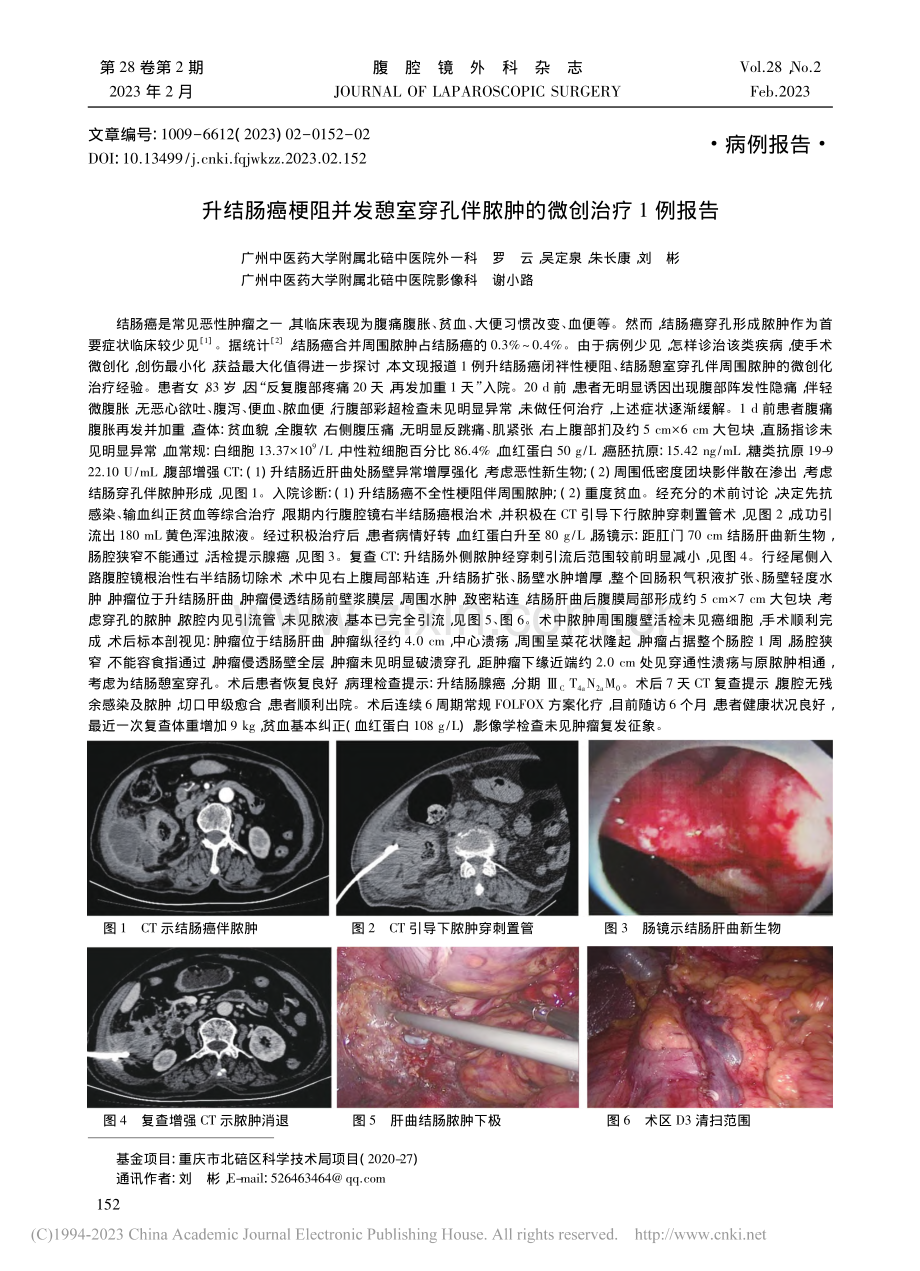 升结肠癌梗阻并发憩室穿孔伴脓肿的微创治疗1例报告_罗云.pdf_第1页