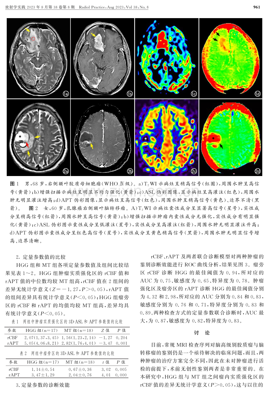 3D-ASL和APT成像鉴别高级别脑胶质瘤与脑转移瘤的临床应用.pdf_第3页