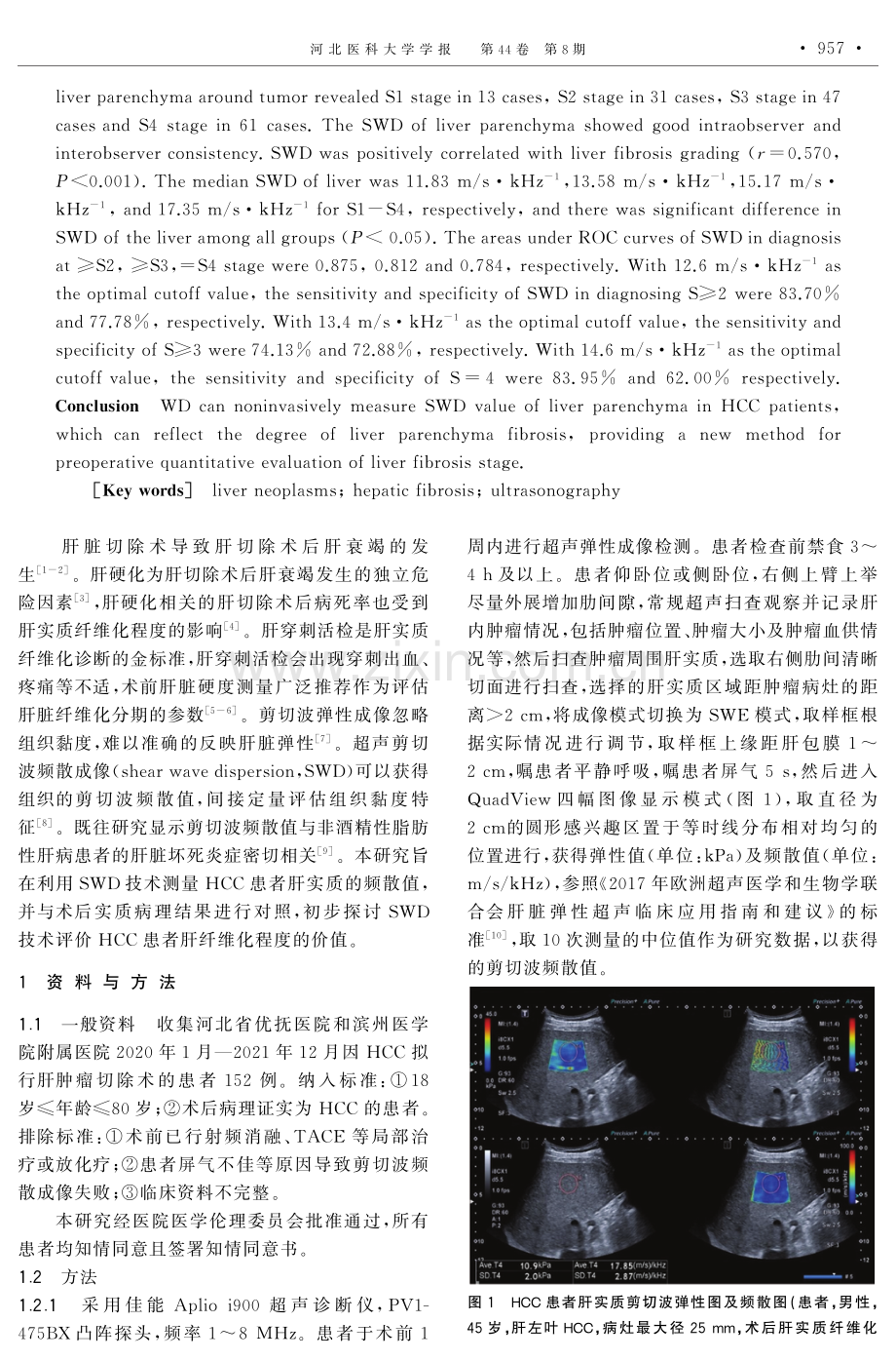 超声剪切波频散成像术前评估肝细胞肝癌患者肝纤维化的初步临床研究.pdf_第2页