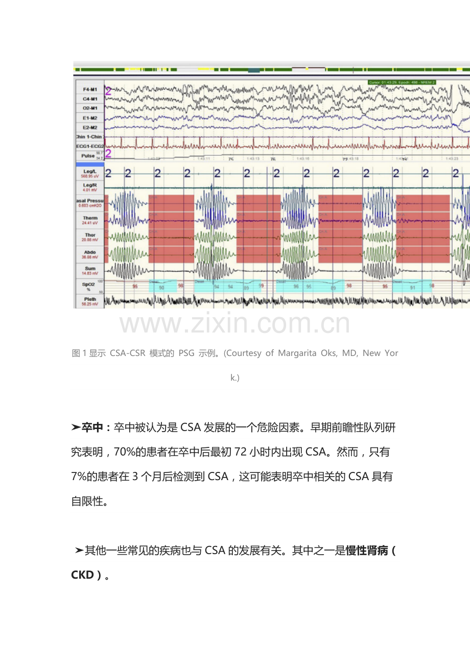 中枢 性呼吸睡眠暂停.docx_第3页