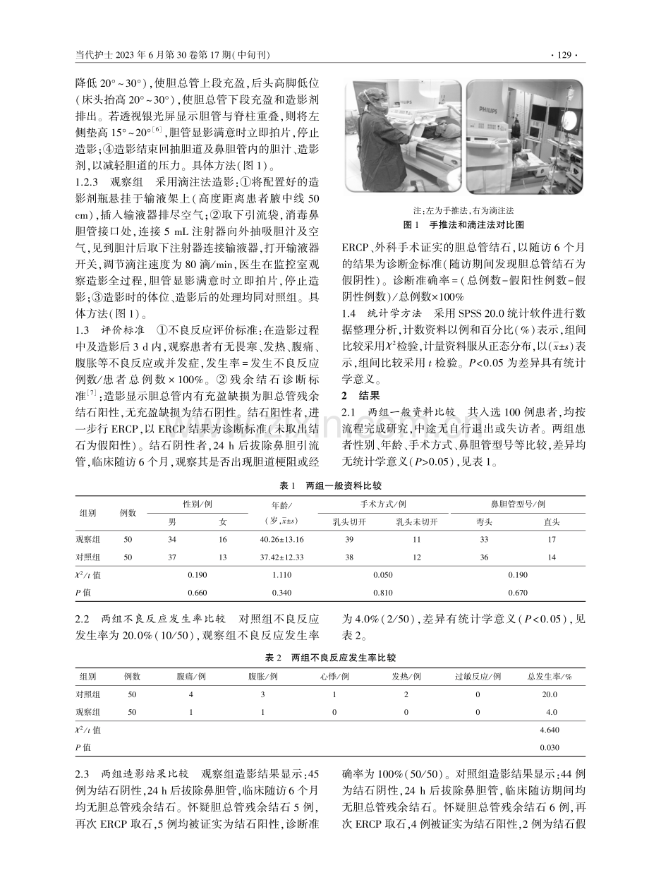 滴注法与手推法鼻胆管胆道造影检查在临床中的对比研究.pdf_第2页