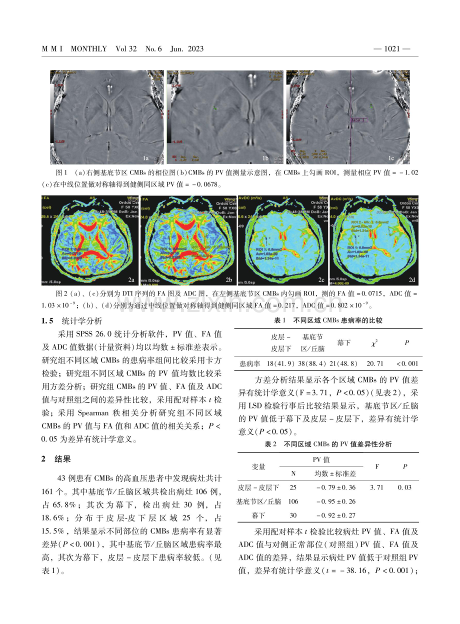 ESWAN及DTI序列在高血压患者脑微出血中的定量评估.pdf_第3页