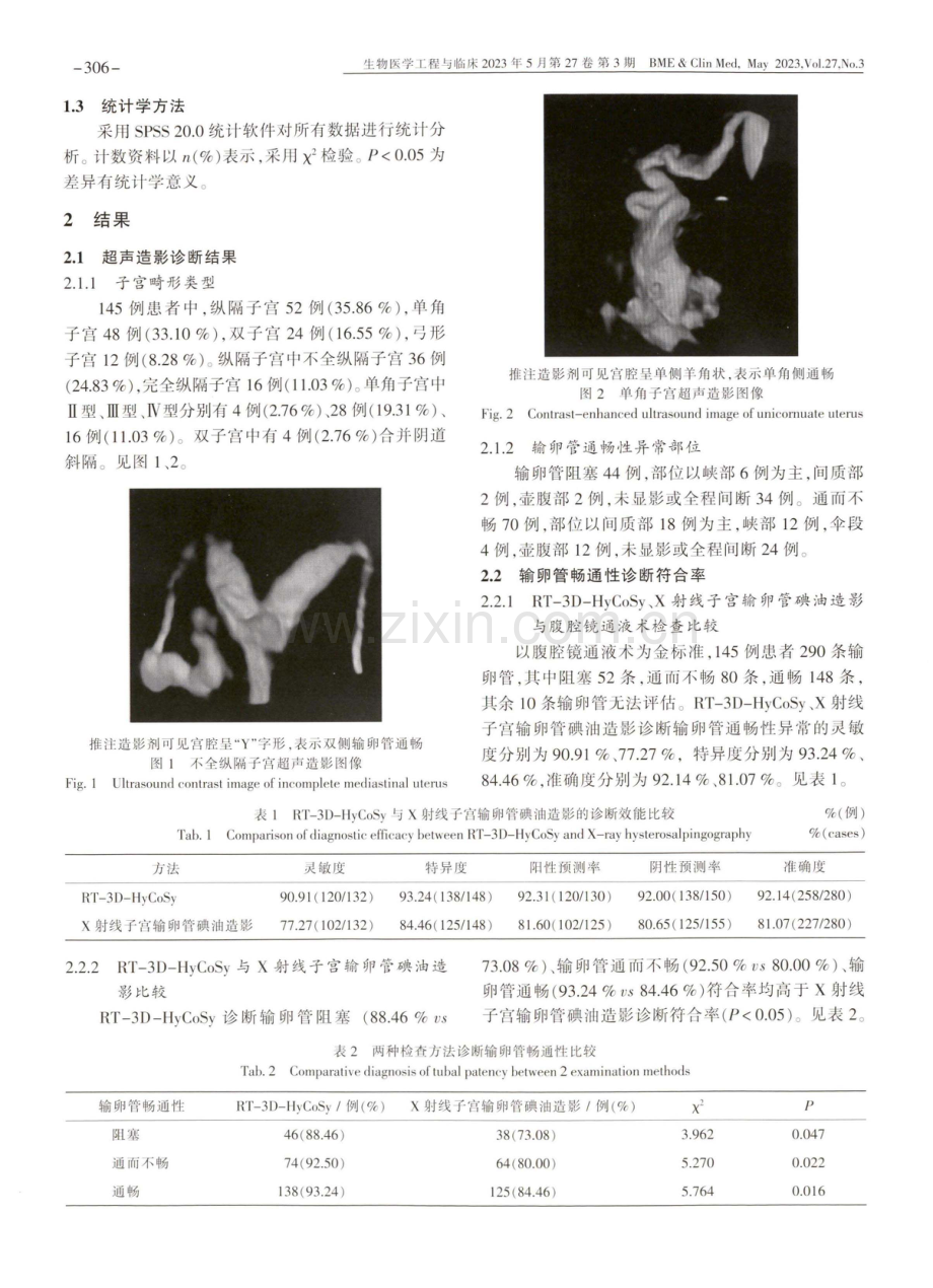 RT-3D-HyCoSy对子宫发育异常不孕症患者输卵管通畅性的评估价值.pdf_第3页