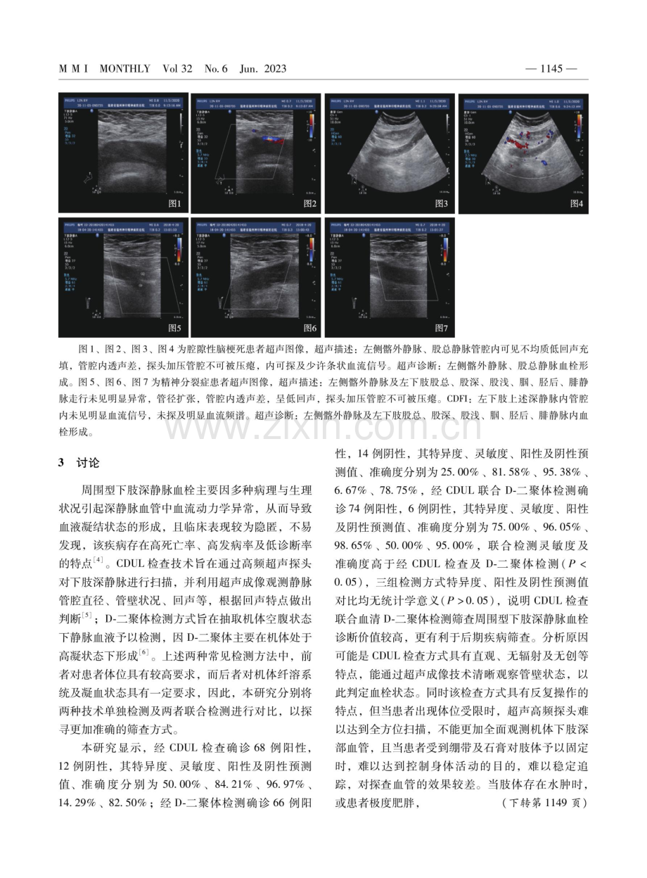 CDUL检查联合血清D-二聚体检测筛查周围型下肢深静脉血栓的价值.pdf_第3页