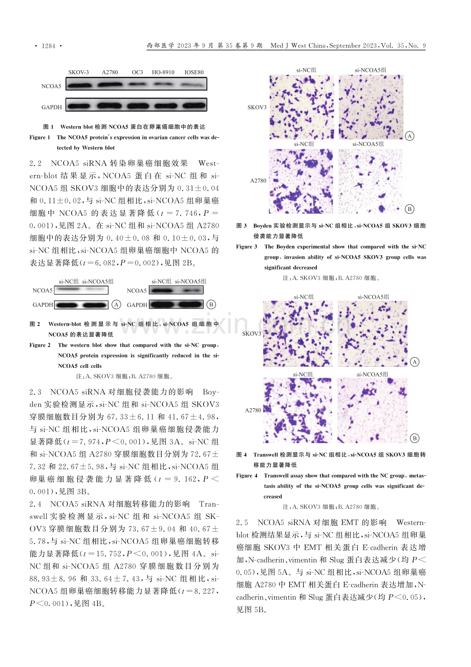 NCOA5通过调控上皮间质转化促进卵巢癌细胞的侵袭转移能力.pdf_第3页