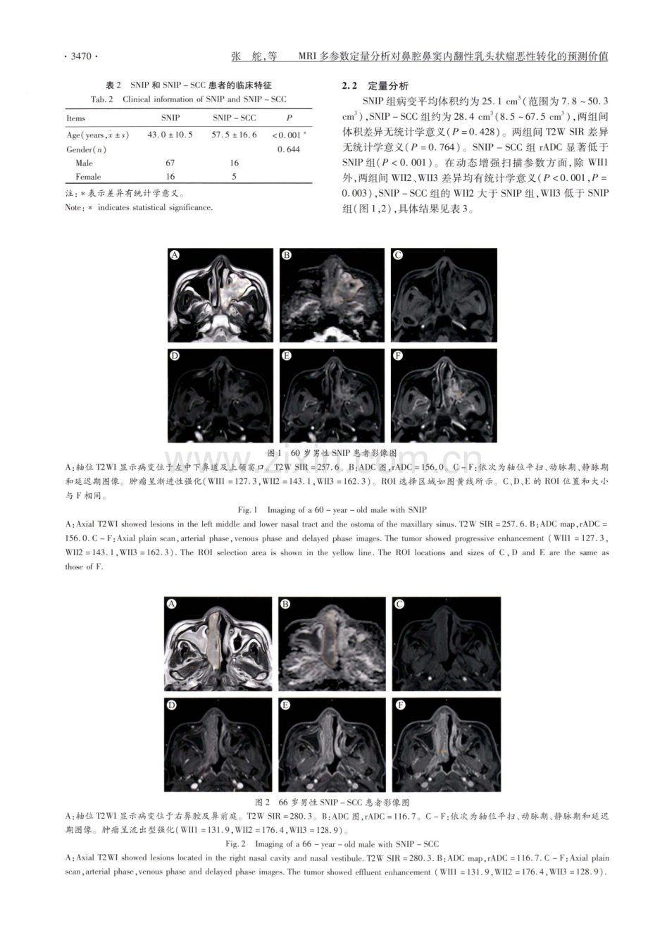 MRI多参数定量分析对鼻腔鼻窦内翻性乳头状瘤恶性转化的预测价值.pdf_第3页