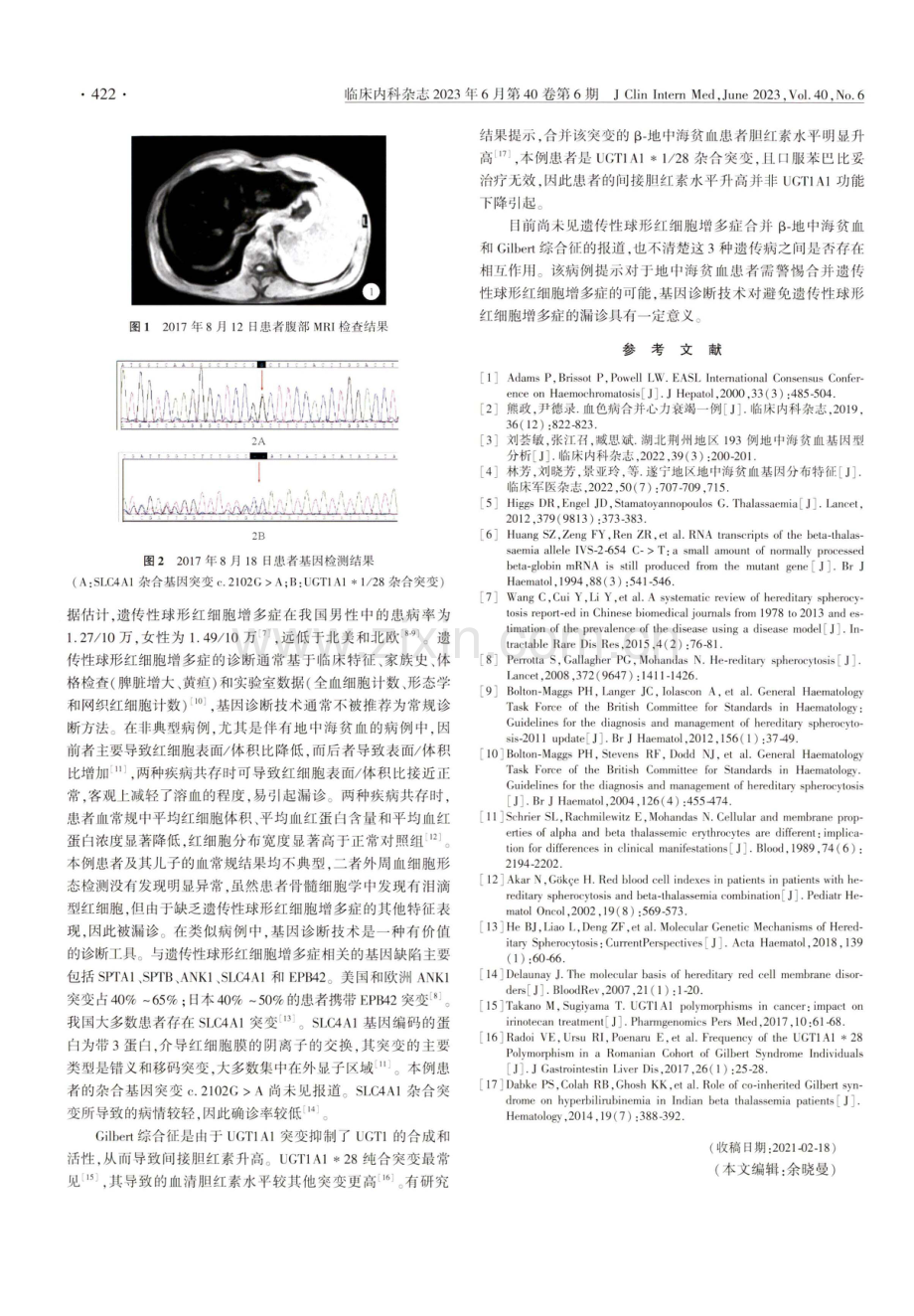 β-地中海贫血合并肝血色病漏诊遗传性球形红细胞增多症一例.pdf_第2页