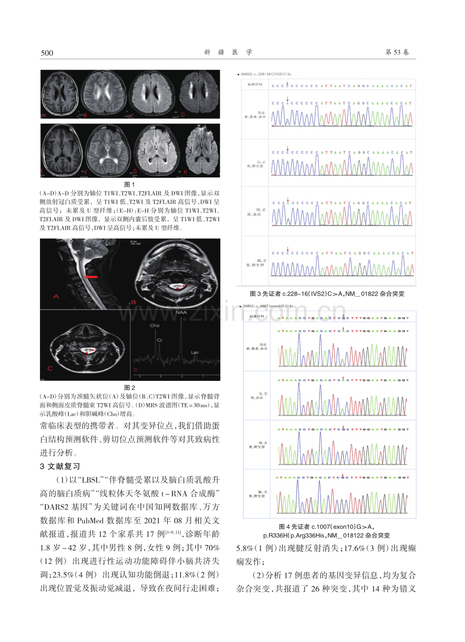 伴脊髓与脑干受累以及脑白质乳酸升高的脑白质病一例并文献复习.pdf_第2页