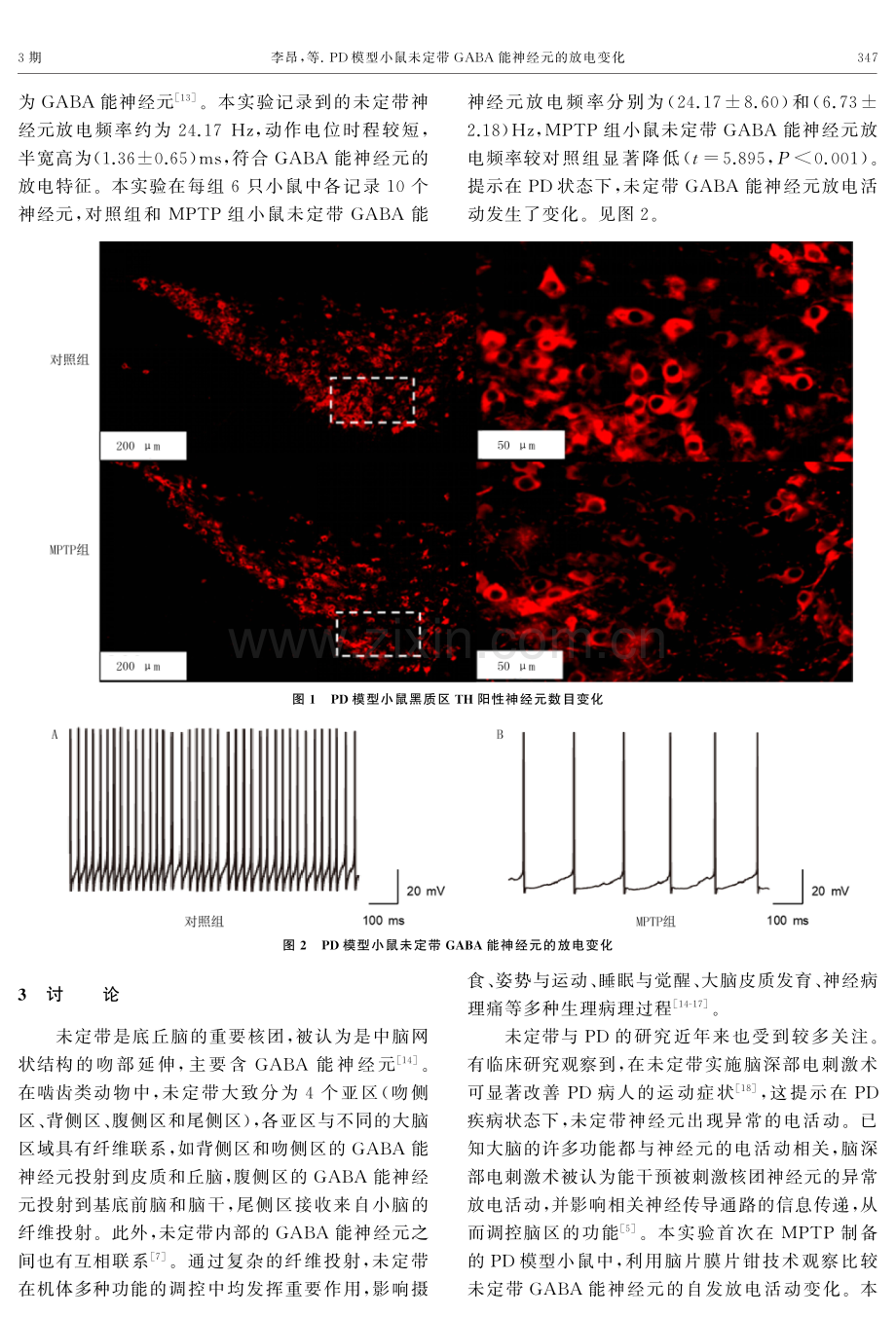 PD模型小鼠未定带GABA能神经元的放电变化.pdf_第3页