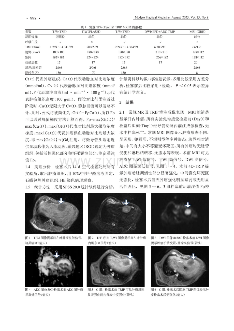 3.0TMR经导管动脉内灌注成像评价不同栓塞方法治疗兔VX2肝肿瘤的栓塞效果.pdf_第3页