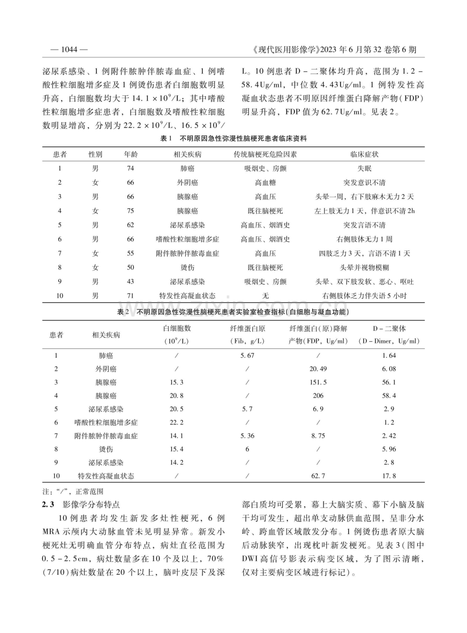 不明原因急性弥漫性脑梗死的影像特点及常见病因.pdf_第3页