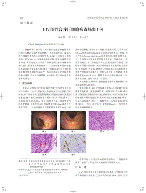 HIV阳性合并巨细胞病毒肠炎1例.pdf