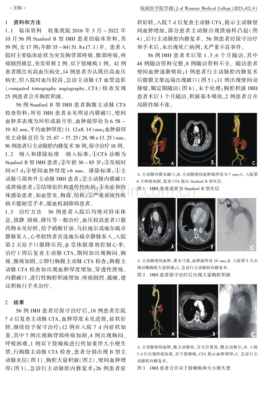 Stanford B型主动脉壁间血肿的治疗策略及疗效.pdf_第2页