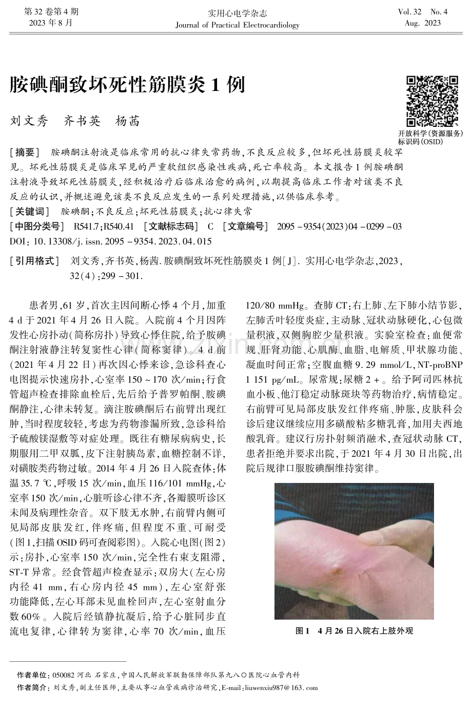 胺碘酮致坏死性筋膜炎1例.pdf_第1页