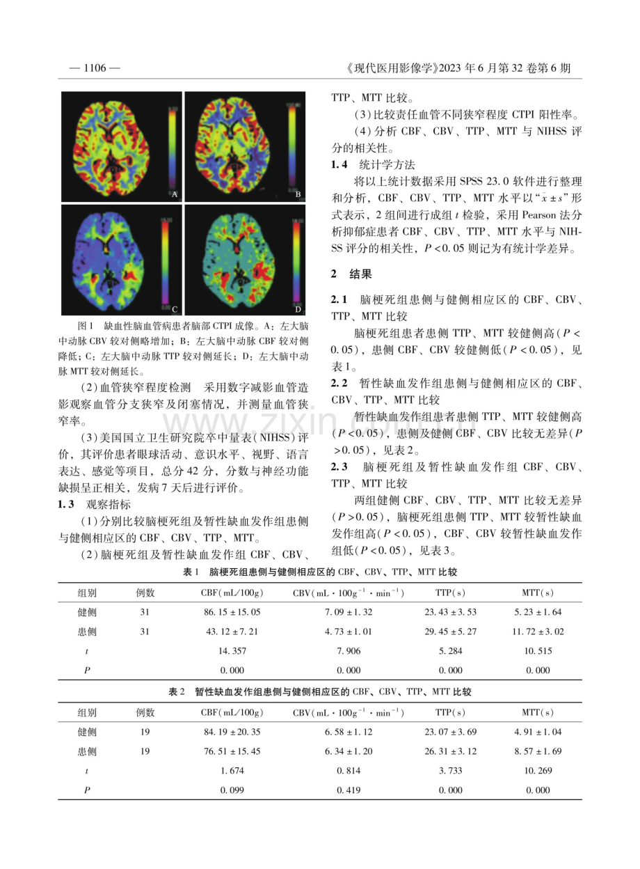 CT灌注成像对缺血性脑血管病患者血管狭窄程度及预后的诊断价值分析.pdf_第2页