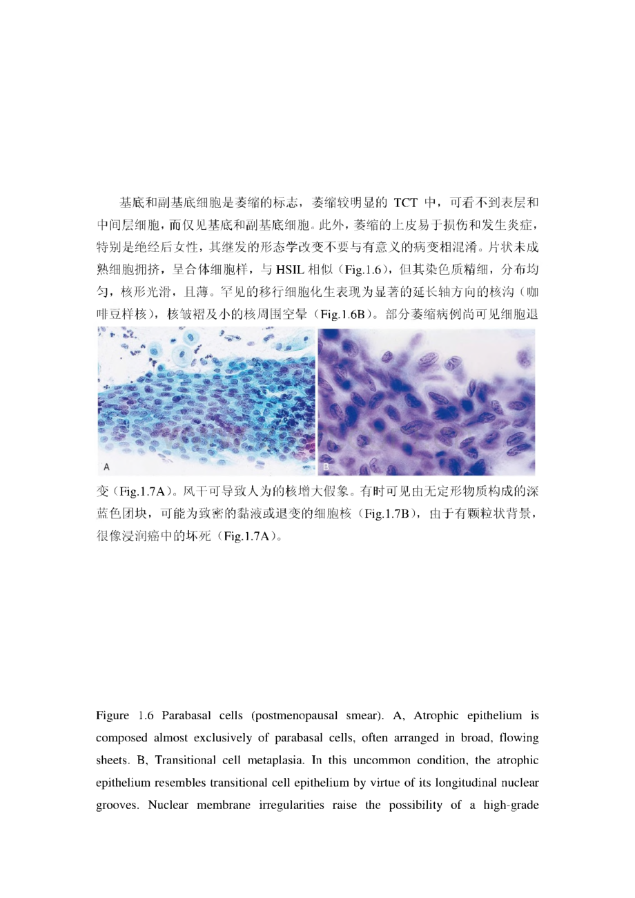 宫颈液基细胞学.pdf_第3页