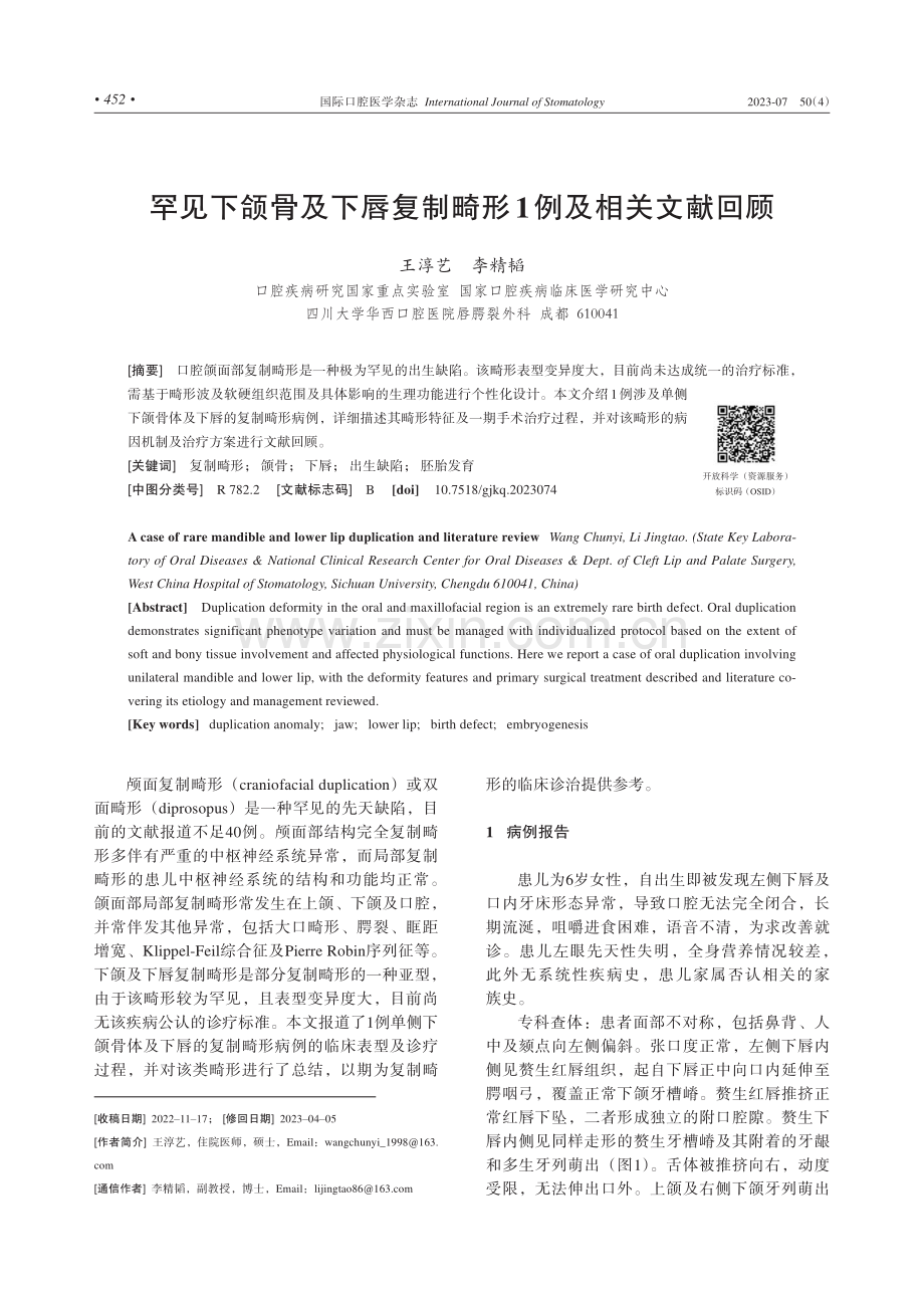 罕见下颌骨及下唇复制畸形1例及相关文献回顾.pdf_第1页