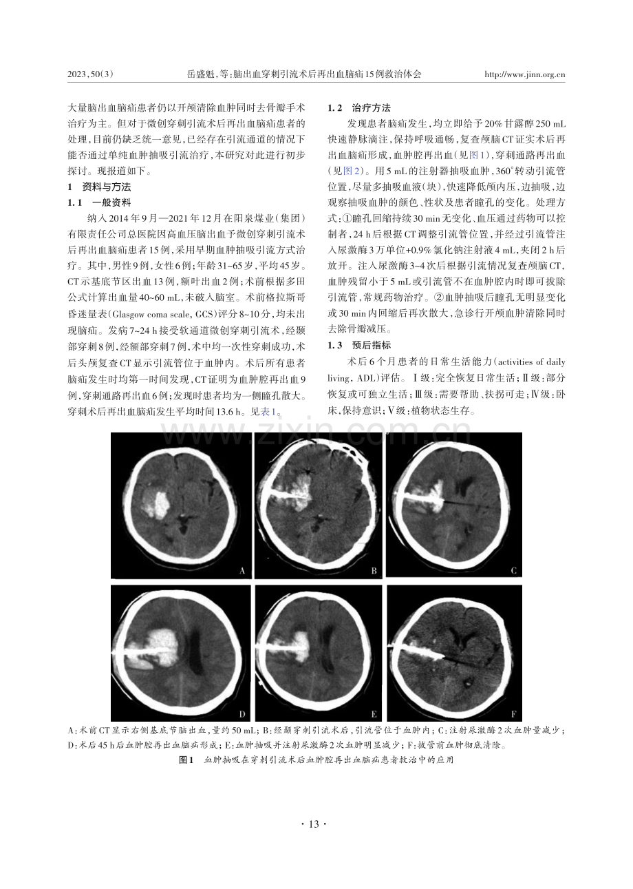 脑出血穿刺引流术后再出血脑疝15例救治体会.pdf_第2页