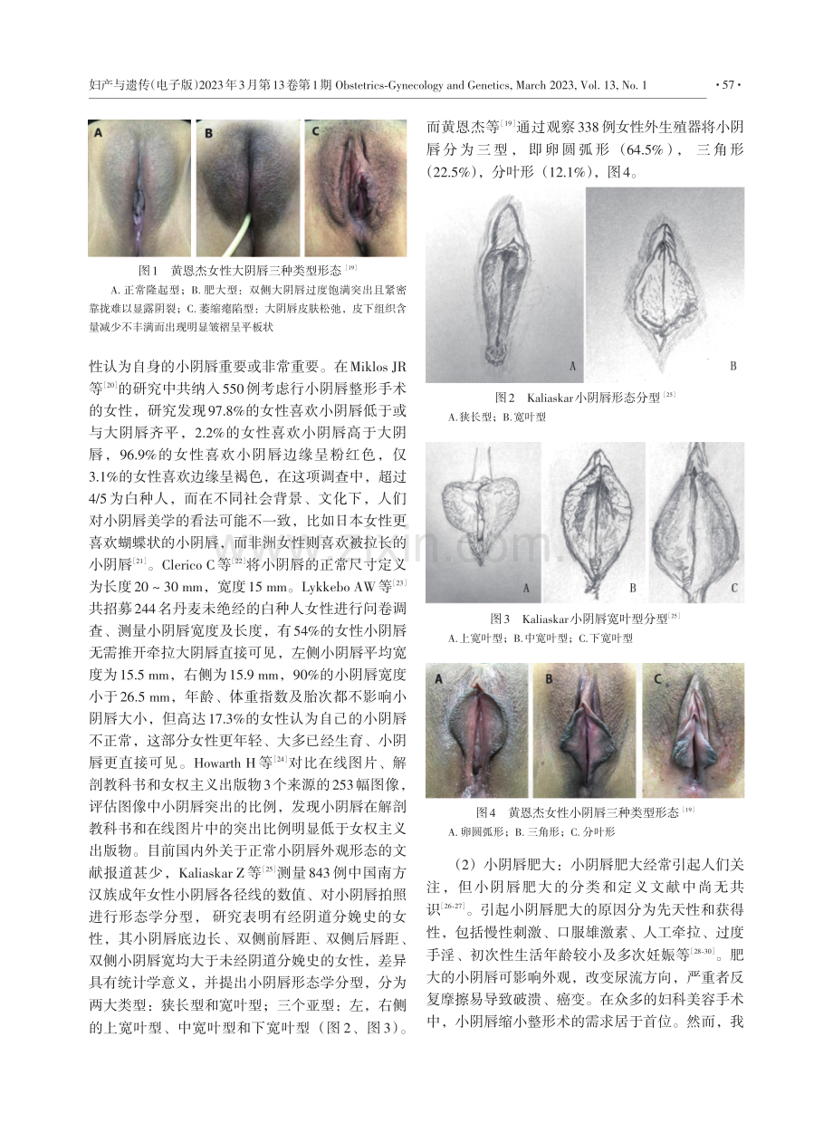 女性外生殖器美学的研究进展.pdf_第3页