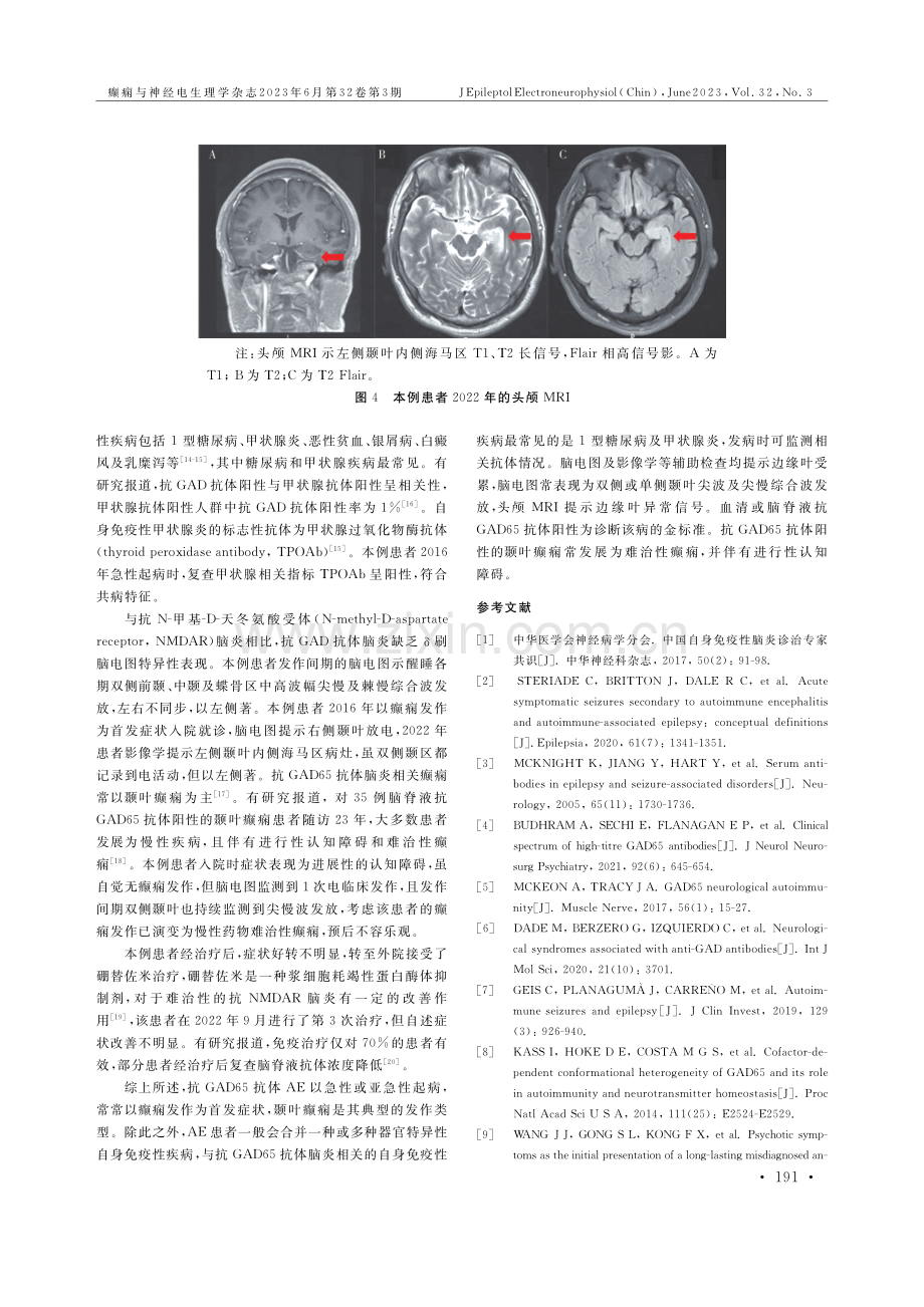 抗谷氨酸脱羧酶65抗体脑炎1例报告.pdf_第3页