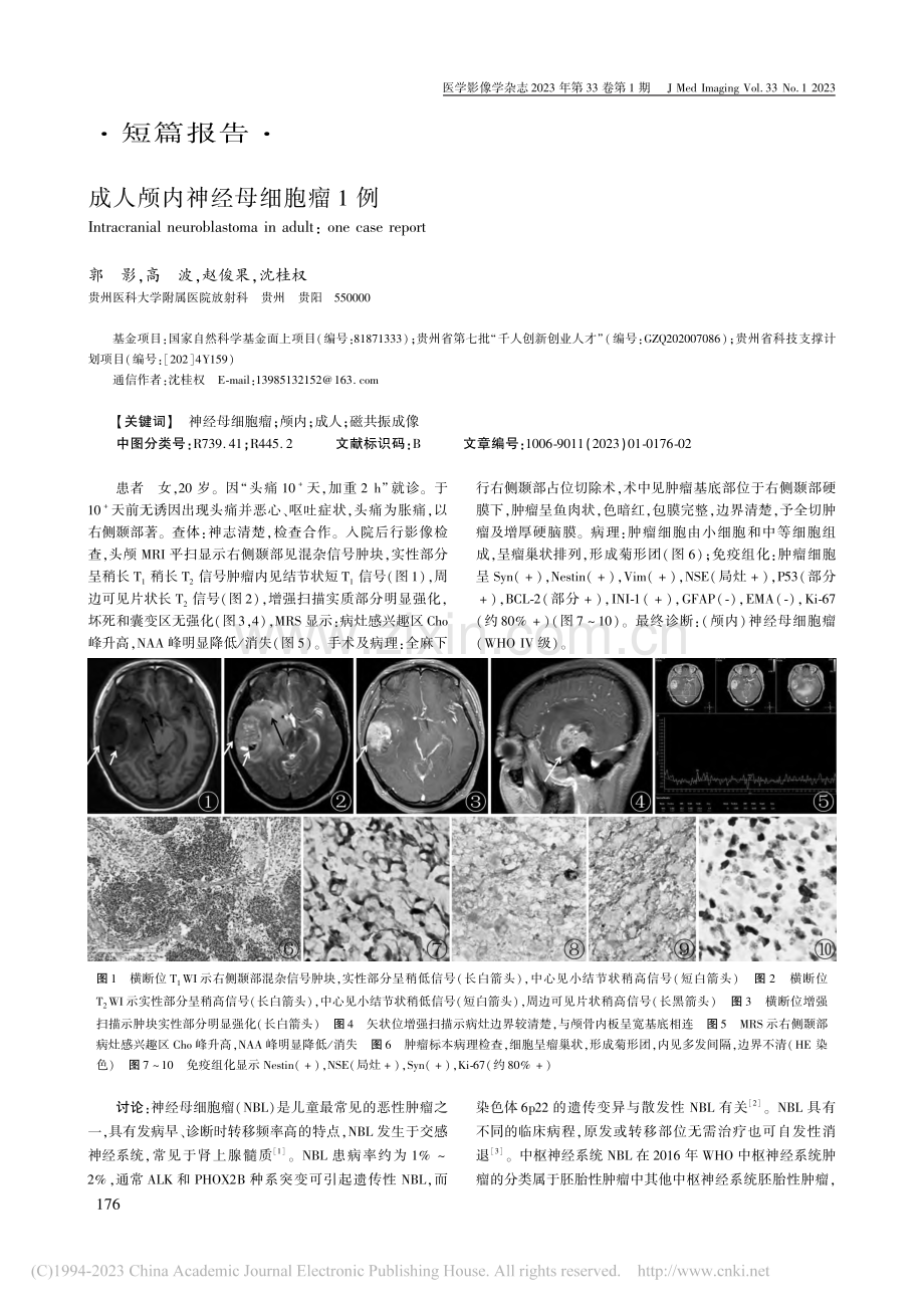 成人颅内神经母细胞瘤1例_郭影.pdf_第1页