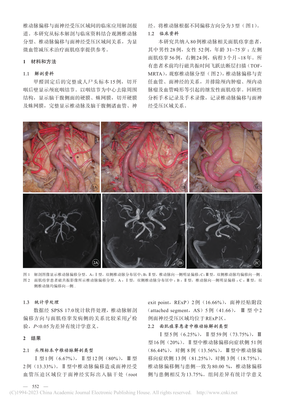 椎动脉解剖学分型及其在微血...减压术治疗面肌痉挛中的应用_代飞虎.pdf_第2页