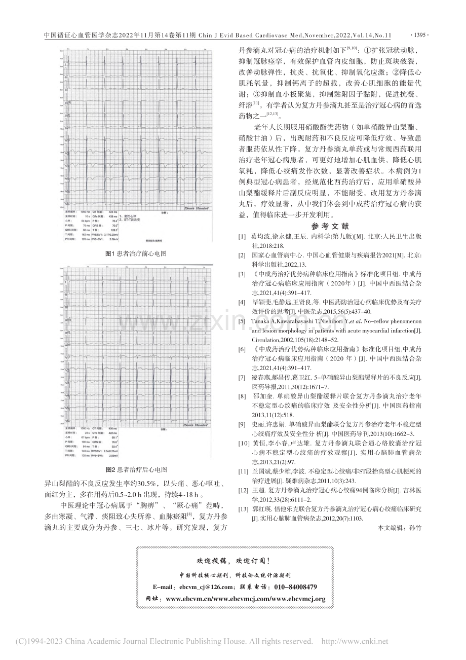 复方丹参滴丸治疗硝酸酯不耐受冠心病患者1例_许佳怡.pdf_第2页