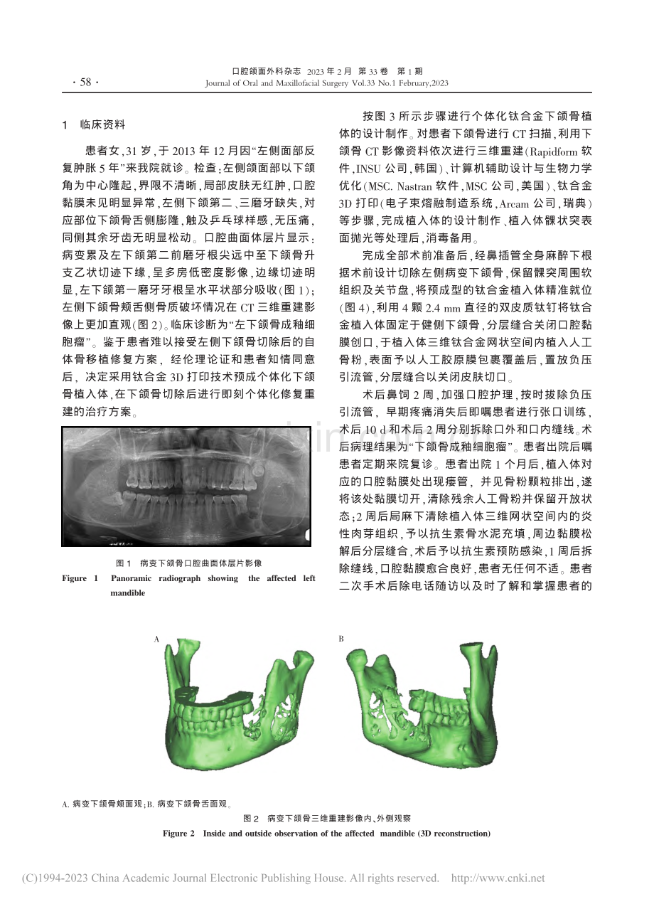 3D打印钛合金植入体下颌骨修复重建远期效果观察1例_张庆福.pdf_第2页