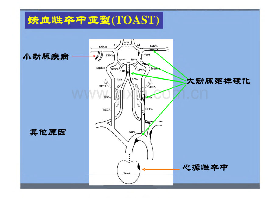 缺血性卒中诊治三重奏.pdf_第3页