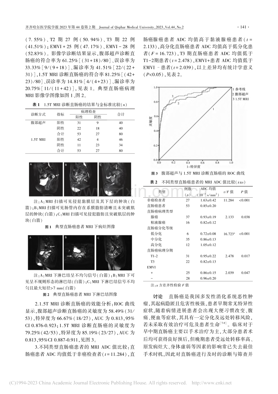 1.5T磁共振在直肠癌诊断中应用_崔凌.pdf_第3页