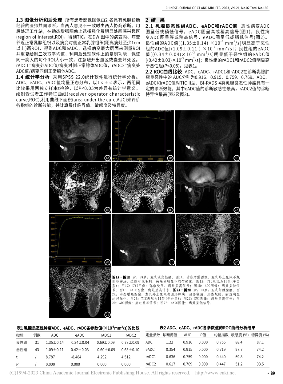 ADC、eADC和rADC...乳腺肿瘤良恶性鉴别诊断价值_韩宝勤.pdf_第2页