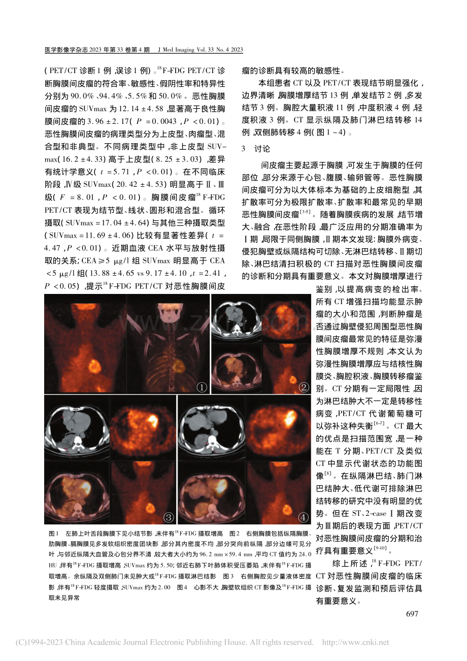 -(18)F-FDG_PE...胸膜间皮瘤诊断中的临床价值_王家富.pdf_第2页