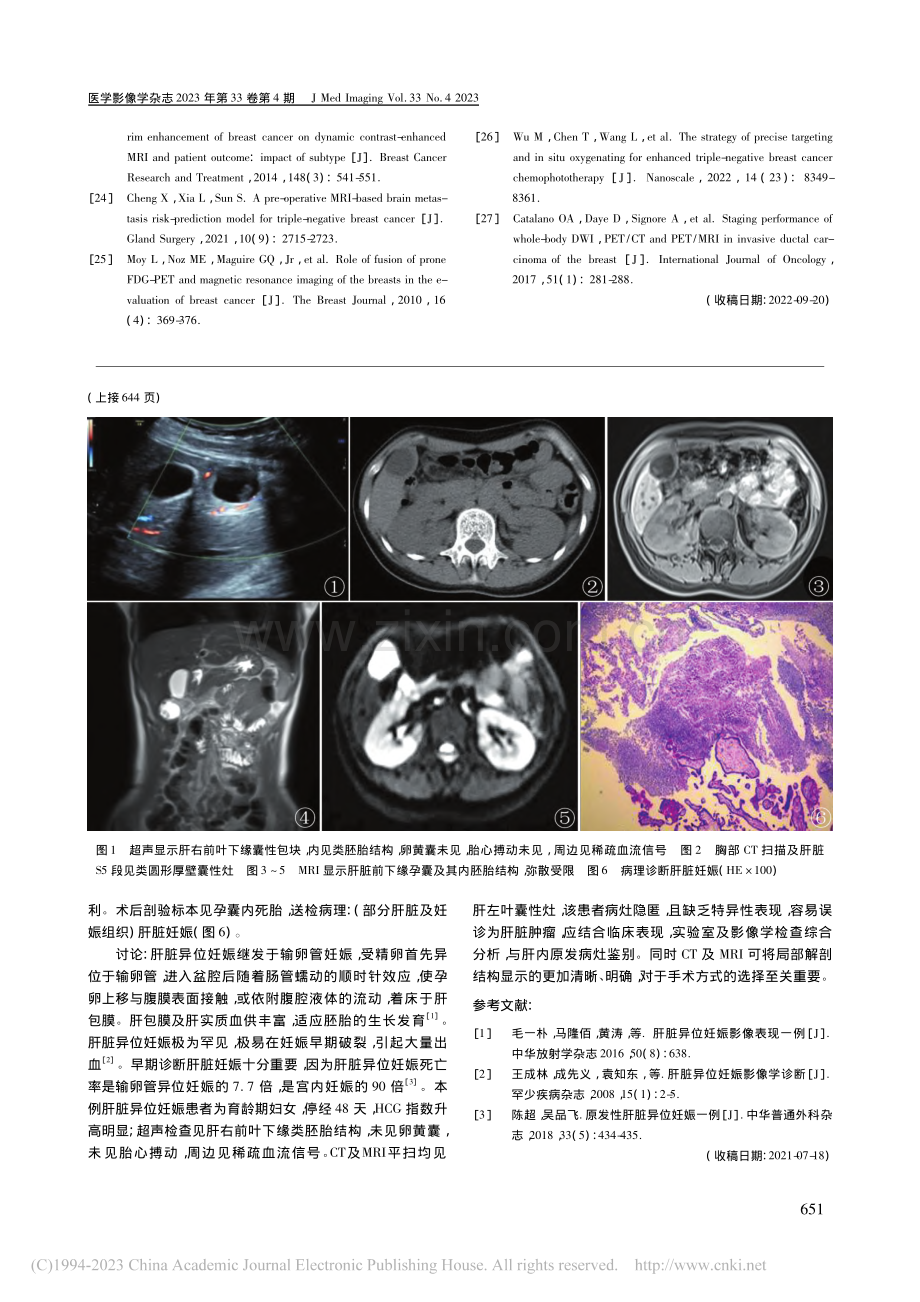 肝脏异位妊娠影像学表现1例_何志强.pdf_第2页