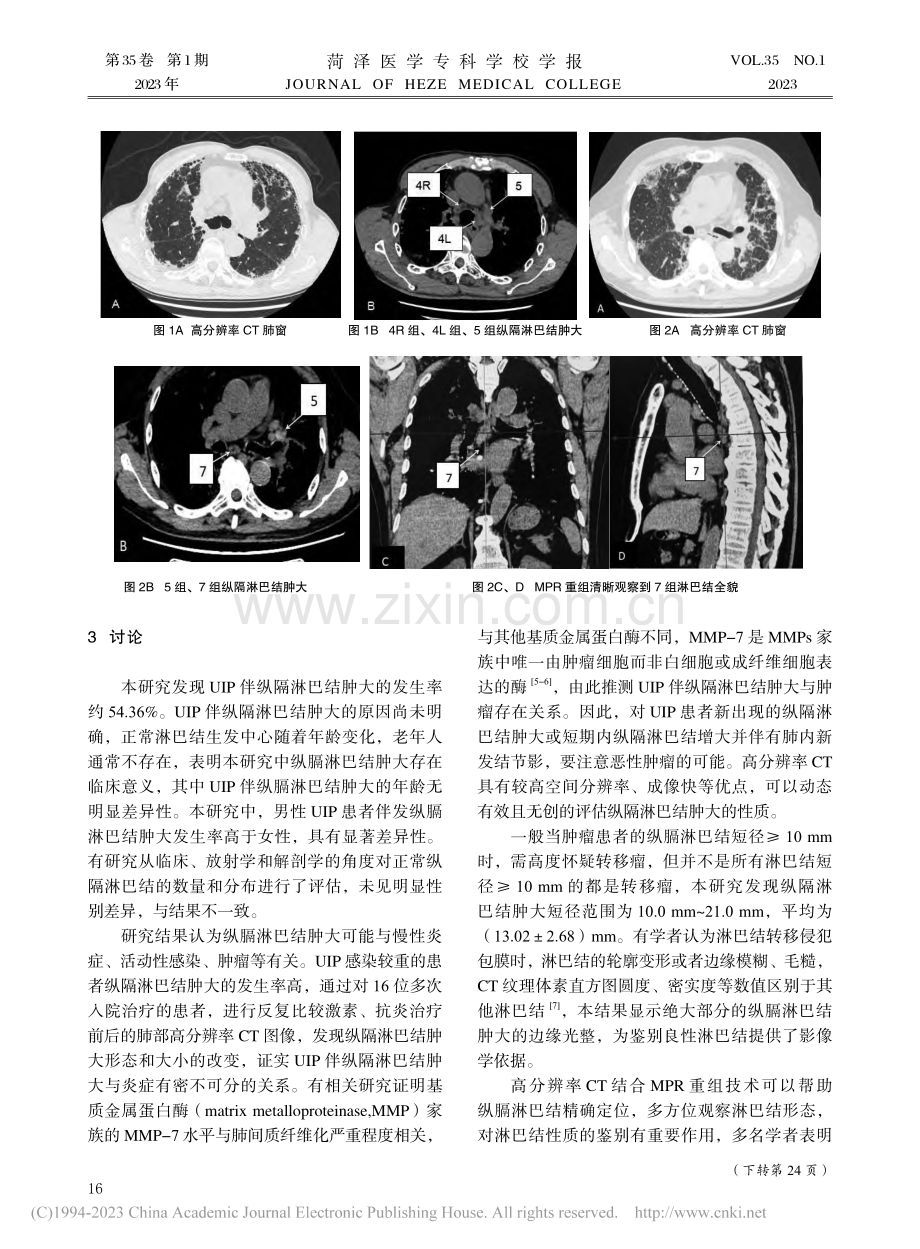 高分辨率CT诊断普通间质性...伴纵隔淋巴结肿大的应用研究_李韶铭.pdf_第3页