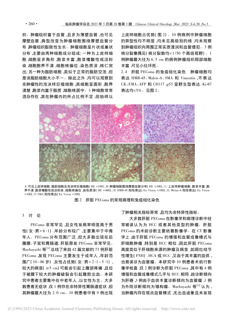 肝脏血管周上皮样细胞肿瘤的临床病理观察_赵苏苏.pdf_第3页